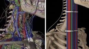 루시 혈관은 오른쪽처럼 생긴거아님?
