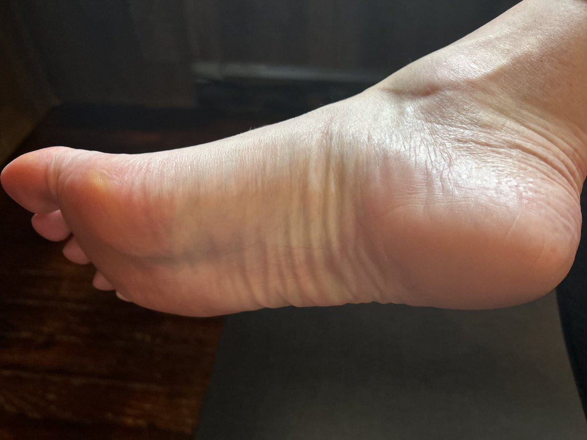 throwbacktoes's tweet photo. Almost there!
#feetfetısh #feetworshi̇p #foot_pics https://t.co/aX6EUkn26J