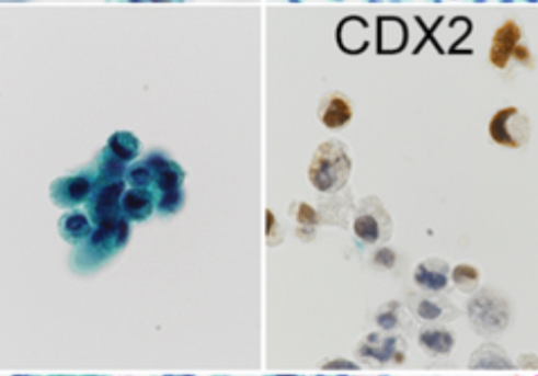 Cytopathology tweet media
