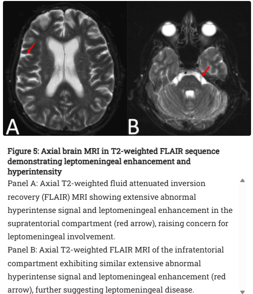 francisdeng's tweet photo. Good morning to everyone except those who don't know the difference between T2 and T2-FLAIR

#journalimage doi: 10.7759/cureus.81602 https://t.co/lCzeMFGsaV