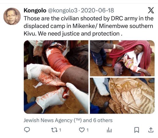 MeKatembo's tweet photo. @kongolo3 , Avant de diffuser des informations, n’oubliez pas que certains cherchent la vérité. Savez-vous ce que subissent les Banyamulenge à Minembwe depuis 2017, victimes de bombardements menés par les FDLR, les FARDC et les FDNB ? @SecRubio @US_SrAdvisorAF https://t.co/EwJWV5oWdj