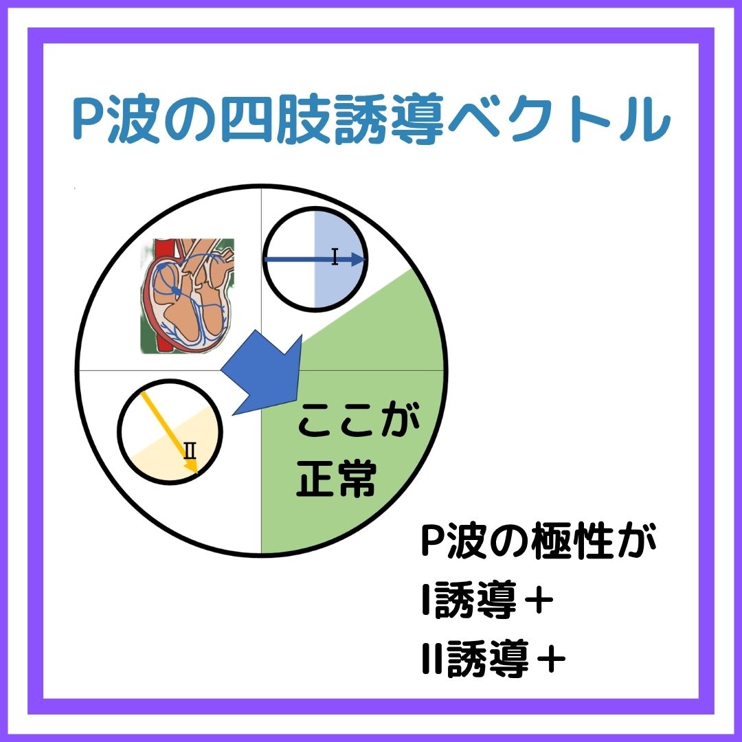 Dr.F@心電's合格塾 tweet media