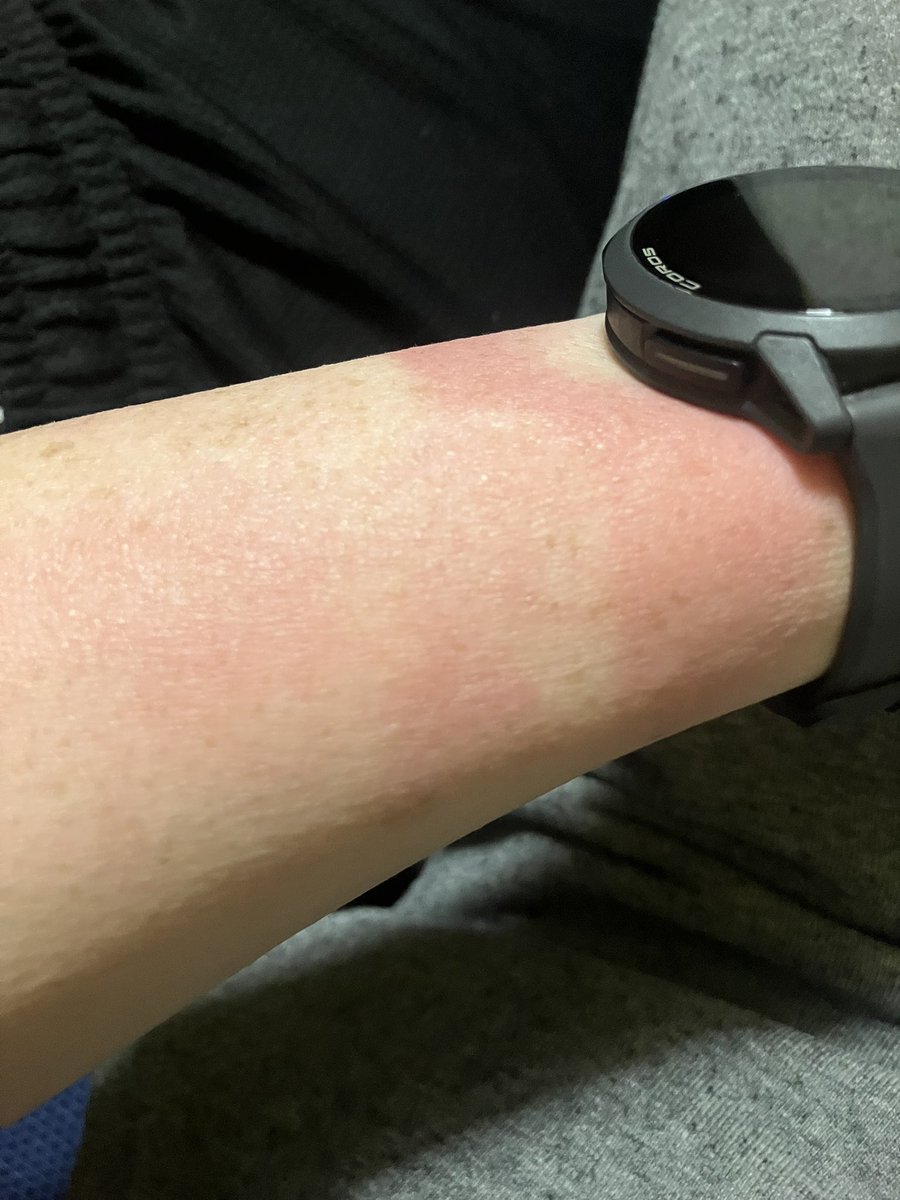 凛(りん)@5/4東京SR・5/30奥武蔵ﾛﾝｸﾞﾄﾚｲﾙ20K tweet media