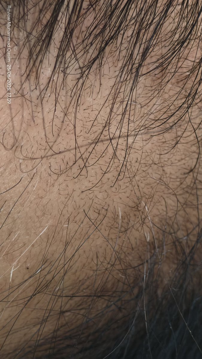 Case Regrowth tweet media