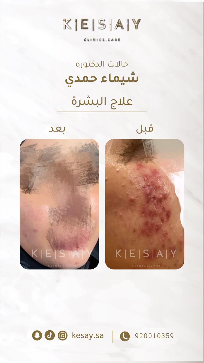 عيادات الكسائي الطبية tweet media