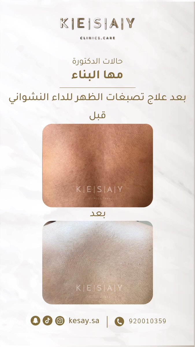 عيادات الكسائي الطبية tweet media