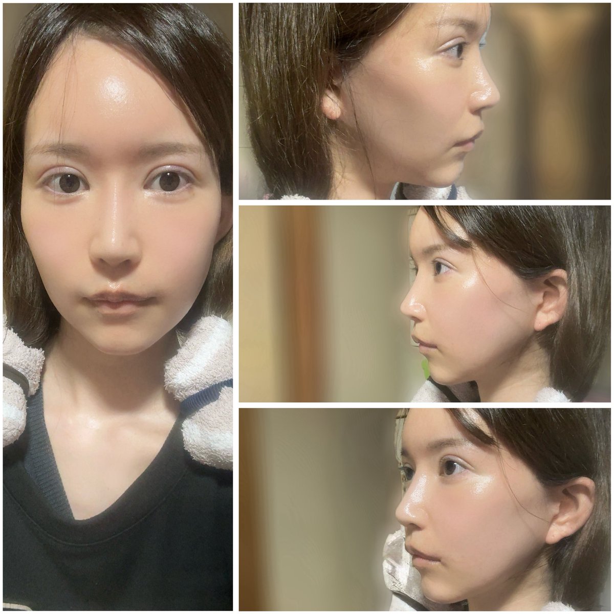 うる@切開リフトDT tweet media