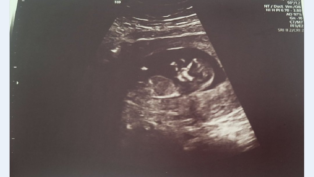 |فاطمه صفری| tweet media