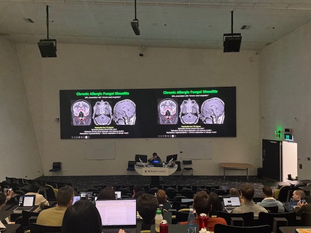 ConferencesToGo's tweet image. Well, that's another day of CME complete💥 Well done to everyone who joined us for this year's Head &amp;amp; Neck Radiology Made Easy Conference with Dr Robin Cassumbhoy, hosted @MonashUni

Thanks to @Imaging_Assoc for sponsoring this superb Imaging update 👏 

#Radiology #Radiologist