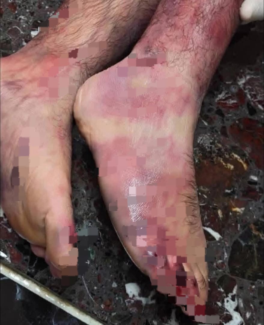 أسـ..رانا في حماكَ يارب💔.
هذه الصورة مُـ.ـسربة لأسـ..ير فلسـ.،ـطيـني من داخل السـ..ـجون.
غيّر الاح..تــلا.ل لون قدميه من التعذيـ،ب !!

تكلموا عن إخوانكم ولا تتوقفوا .. اجعلوهم حديث العالم

💔💔