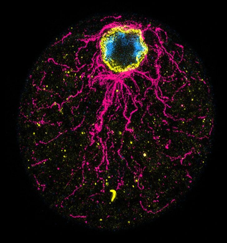 🚨: Medical scientists transplanted lab grown retinal cells that restored partial vision in completely blind patients