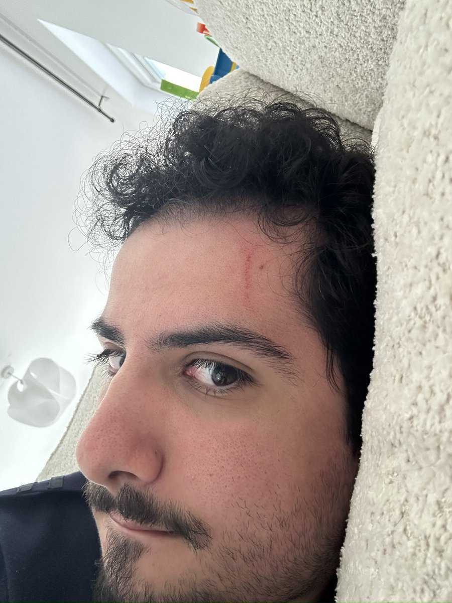 aphrosar's tweet photo. Je me suis griffé le visage solo en me réveillant en sursaut 🫥
#LGBTQIAAprilVibes https://t.co/f2cU27oIoC