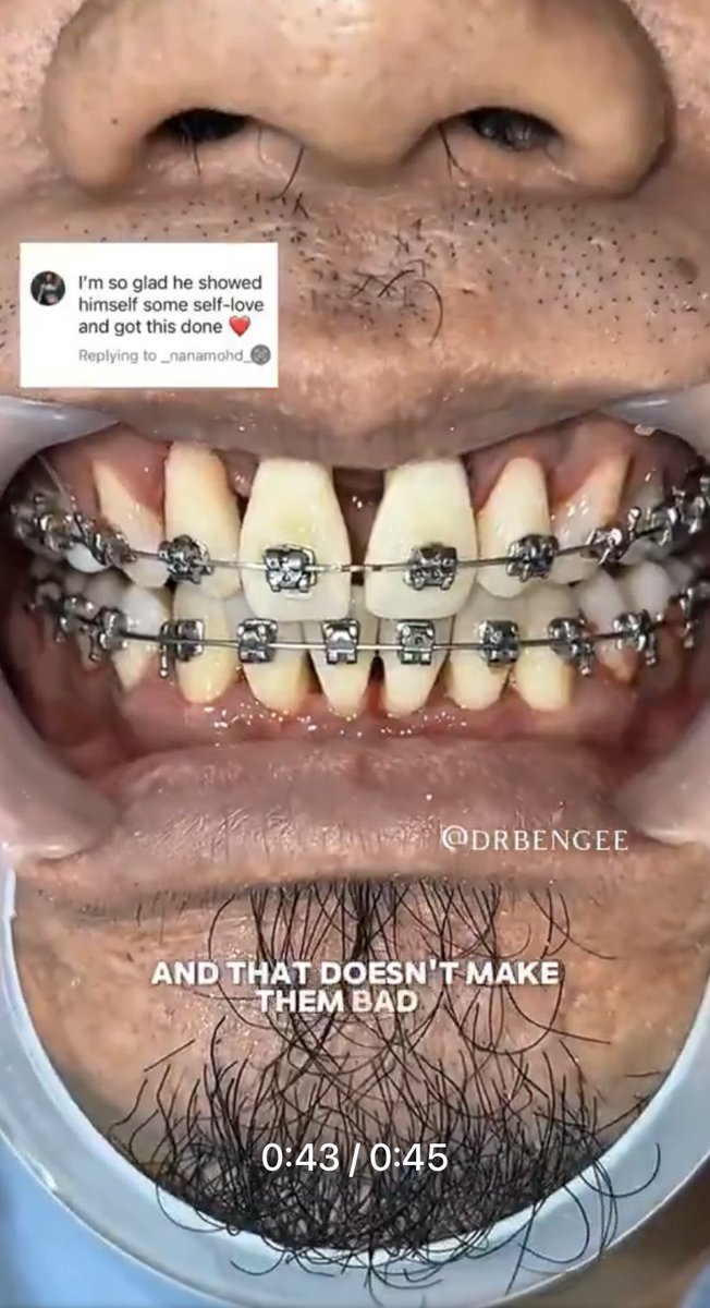 ötekizede tweet media