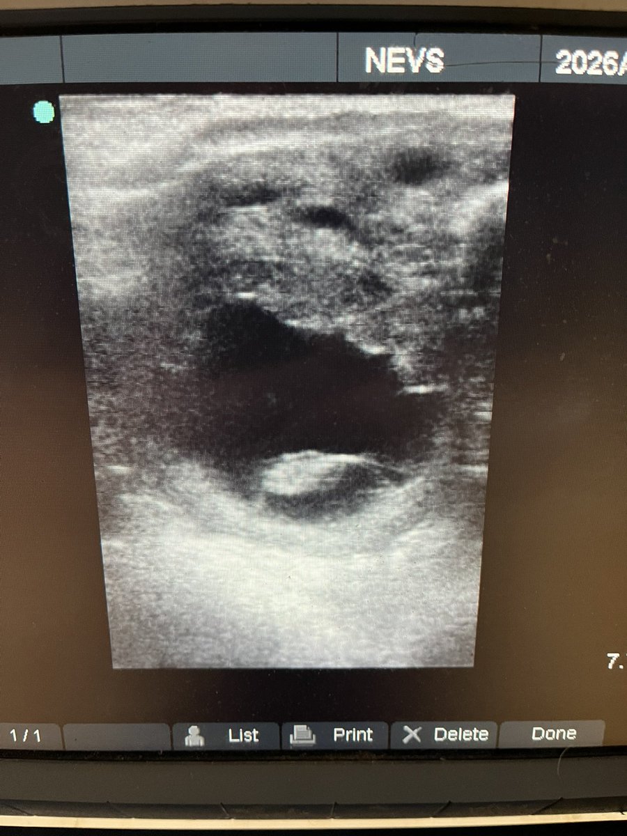 ferdlantstud's tweet photo. Heartbeat scan this morning of Minister For Magic’s pregnancy to Mill Stream. All looking fine.
@YeomanstownStud https://t.co/JDKo41FY7q