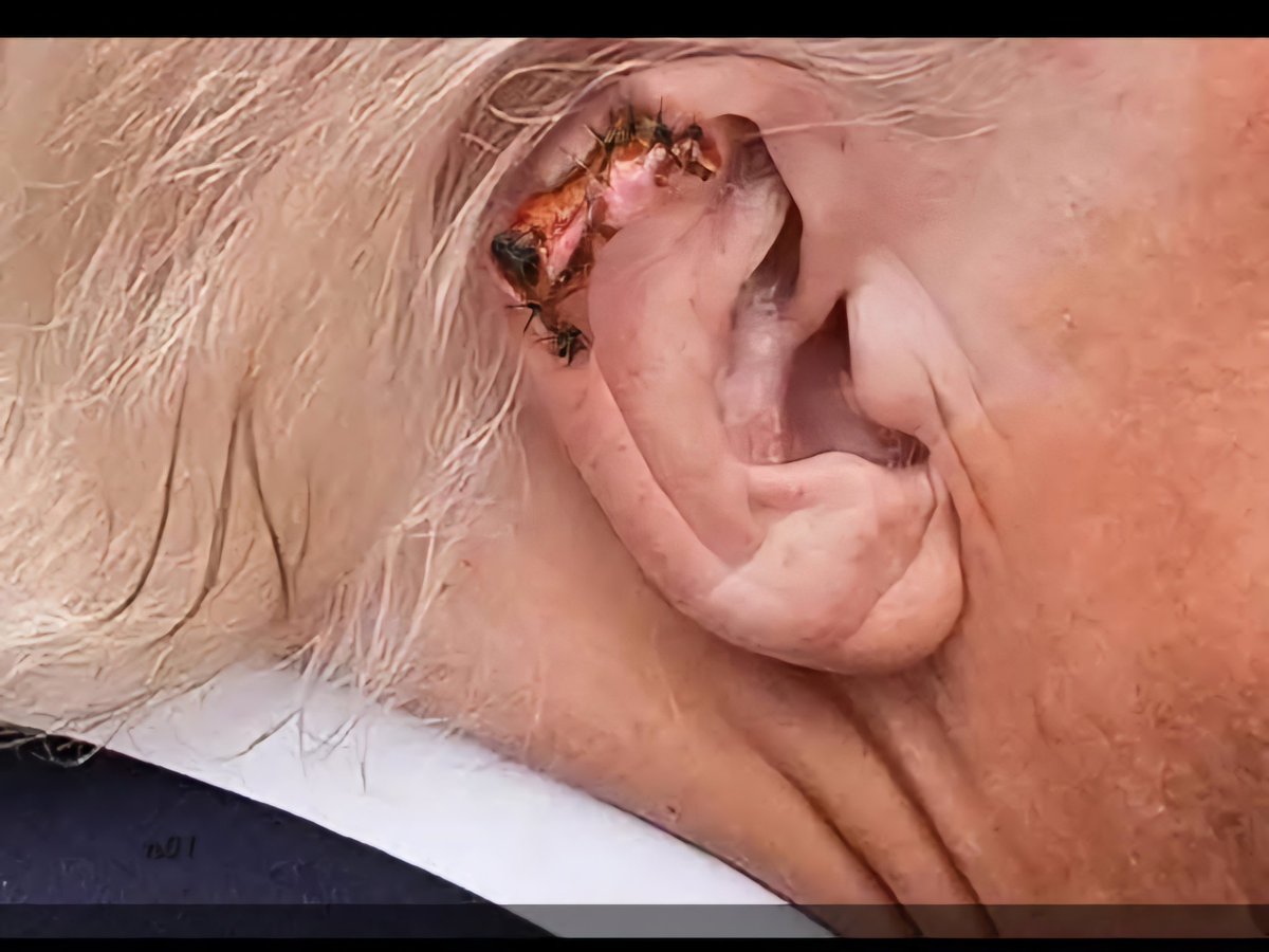 Noonejimenez's tweet image. #trump #ear #hoax