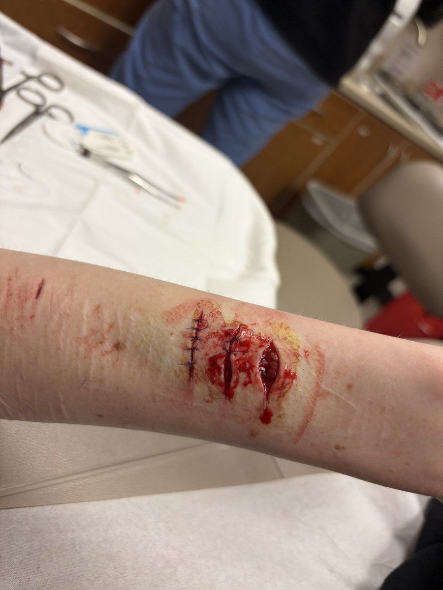 VIX OF #SHTWT tweet media