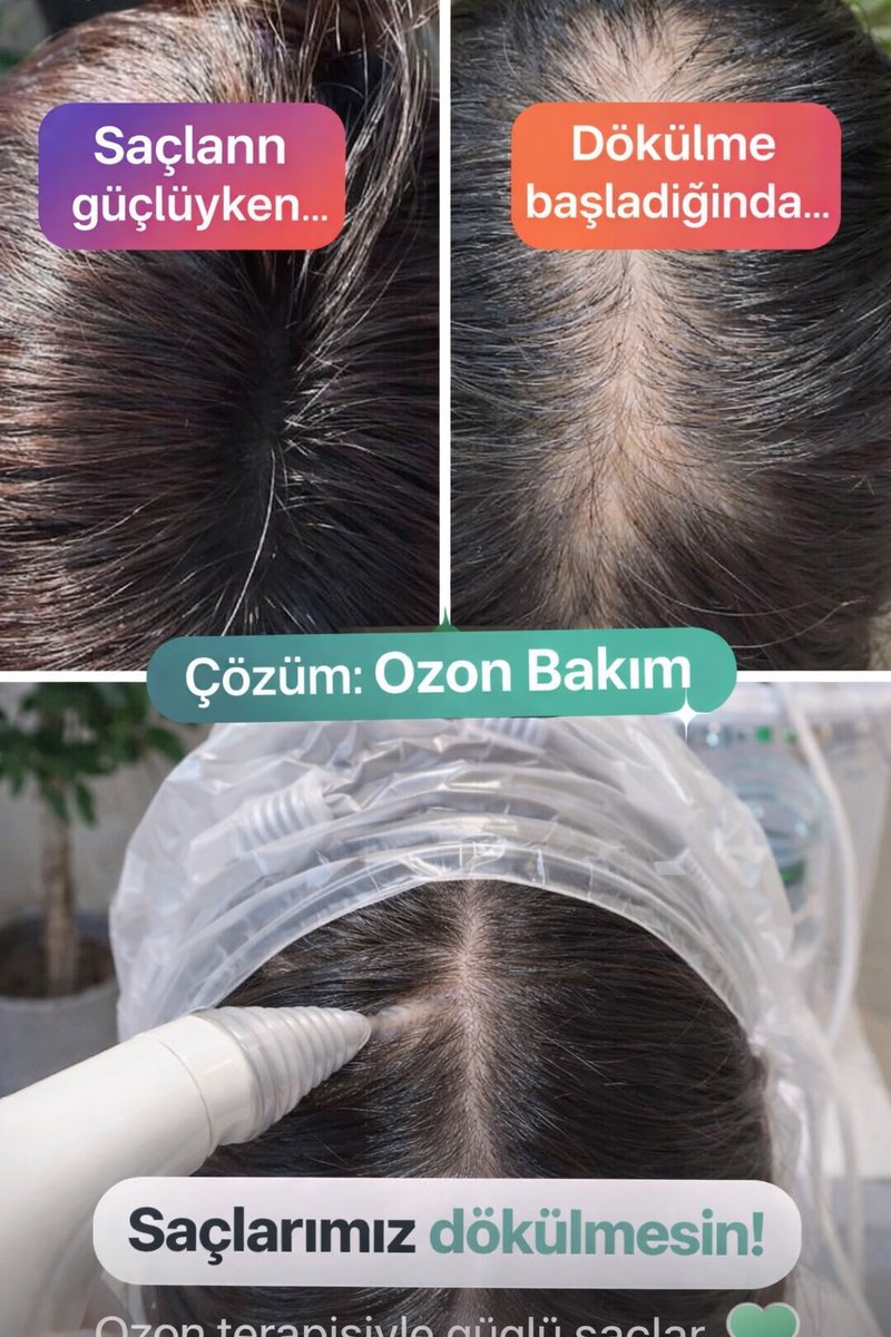 IKsssss's tweet photo. Saçlarınız dökülüyorsa @byisikbeauty .florya instagram sayfası inanılmaz sonuçlar https://t.co/qKMqdkhTix