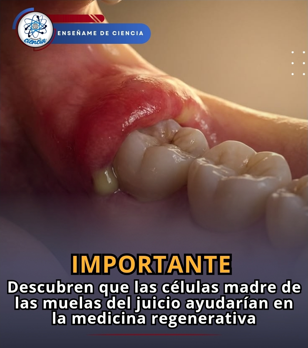 🚨Los expertos dicen que <<la pulpa dental de las muelas del juicio contiene células madre multipotenciales, capaces de contribuir no solo en tratamientos odontológicos, sino también en el abordaje de diversas enfermedades sistémicas>>.
Es decir, las células madre que se pueden