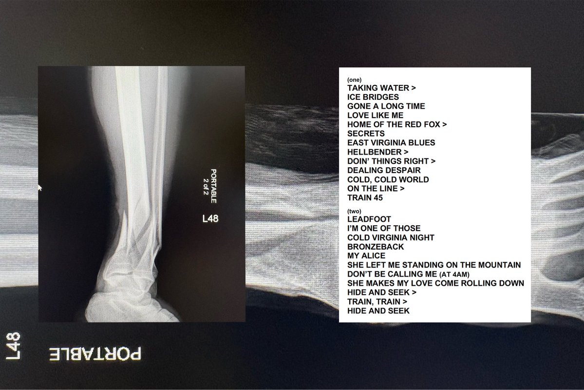 Billy Strings tweet media