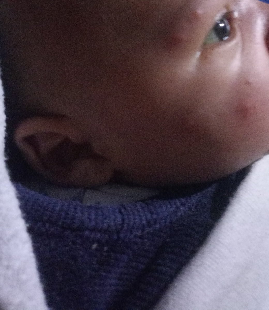 doaamostaf22's tweet photo. Your donation helps my family and me continue living and cover the costs of the tent. Look, insects have devoured my children's bodies. Please help!  Thank you so much from the bottom of my heart for everything. Any donation, no matter how small, makes me https://t.co/w9fROwfcMF https://t.co/8aav1ip2d5