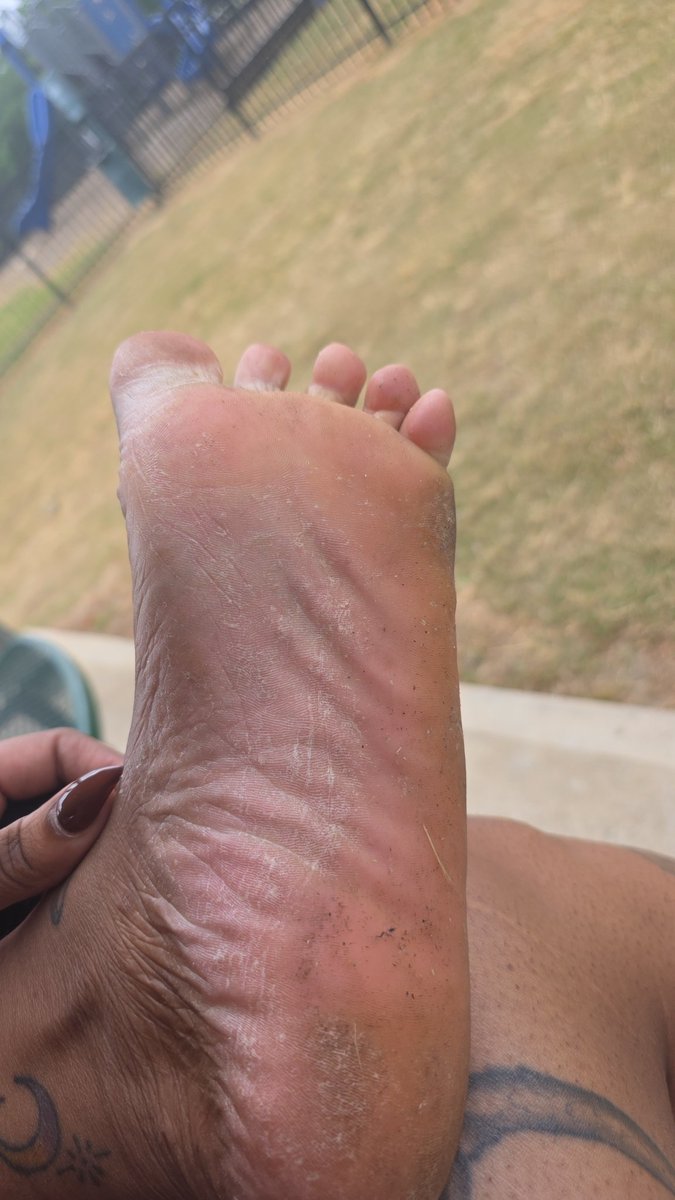 LotsuToes's tweet photo. Dirty Dry Soles. Lick them smell them https://t.co/7RmSnQhQyR
