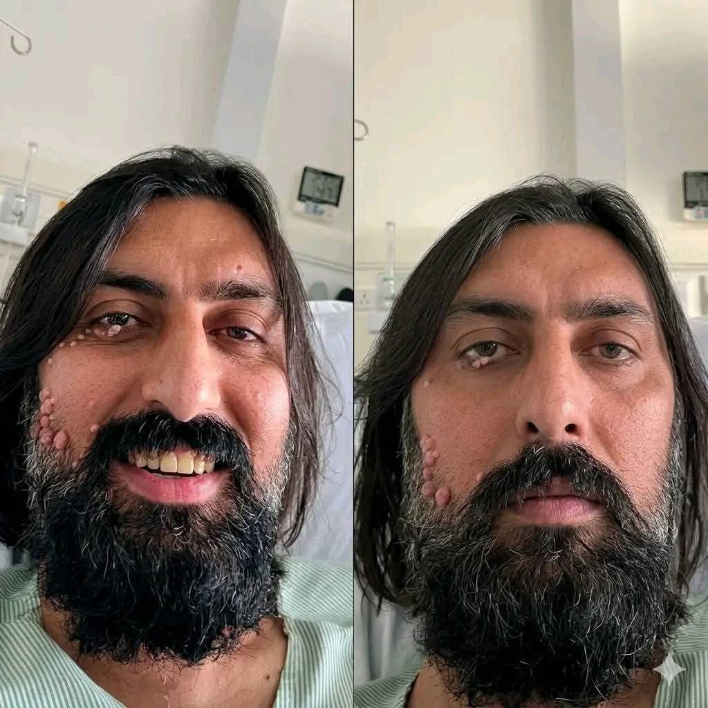 Ahmdzai1997's tweet image. د دنیا نعمتونه د همېش لپاره نه وي!
نه ځواني پاتې کېږي، نه رعب او دبدبه، نه شان او شوکت او نه روغ صحت! 😳💔
رب د ژر راجوړ کړه رنځورۀ یاره.! 🤲🏻🙏🏻
.
.
.

#pray #for #shapoorzadran #speedyrecovery #afghanistancricket