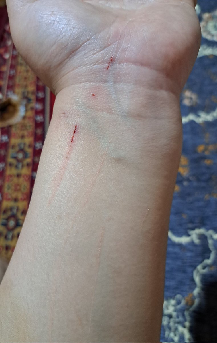 اینهمه ب گربه محبت کن
بهش غذا بده
بفکر پا درد و کون درد و کمر دردش باش
تهش میشه این😒
کثافتای نمک نشناس🥲