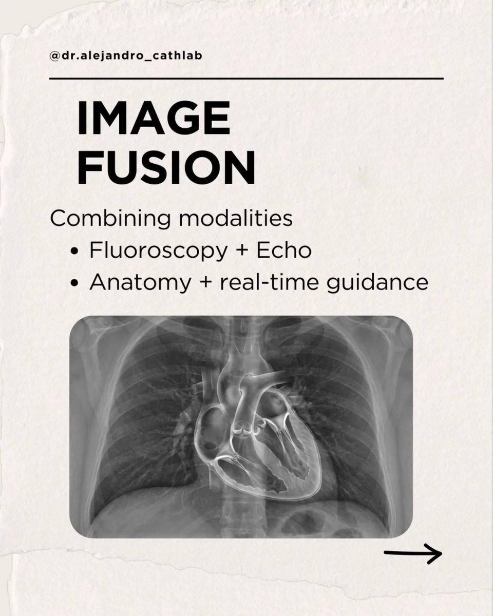 cardioalejandro's tweet image. 🔍 Each modality plays a distinct role:
• Fluoroscopy → real-time device navigation
• Echocardiography → soft tissue and valve interaction
• Cardiac CT → anatomical planning and sizing
#Cardiology #MedicalImaging