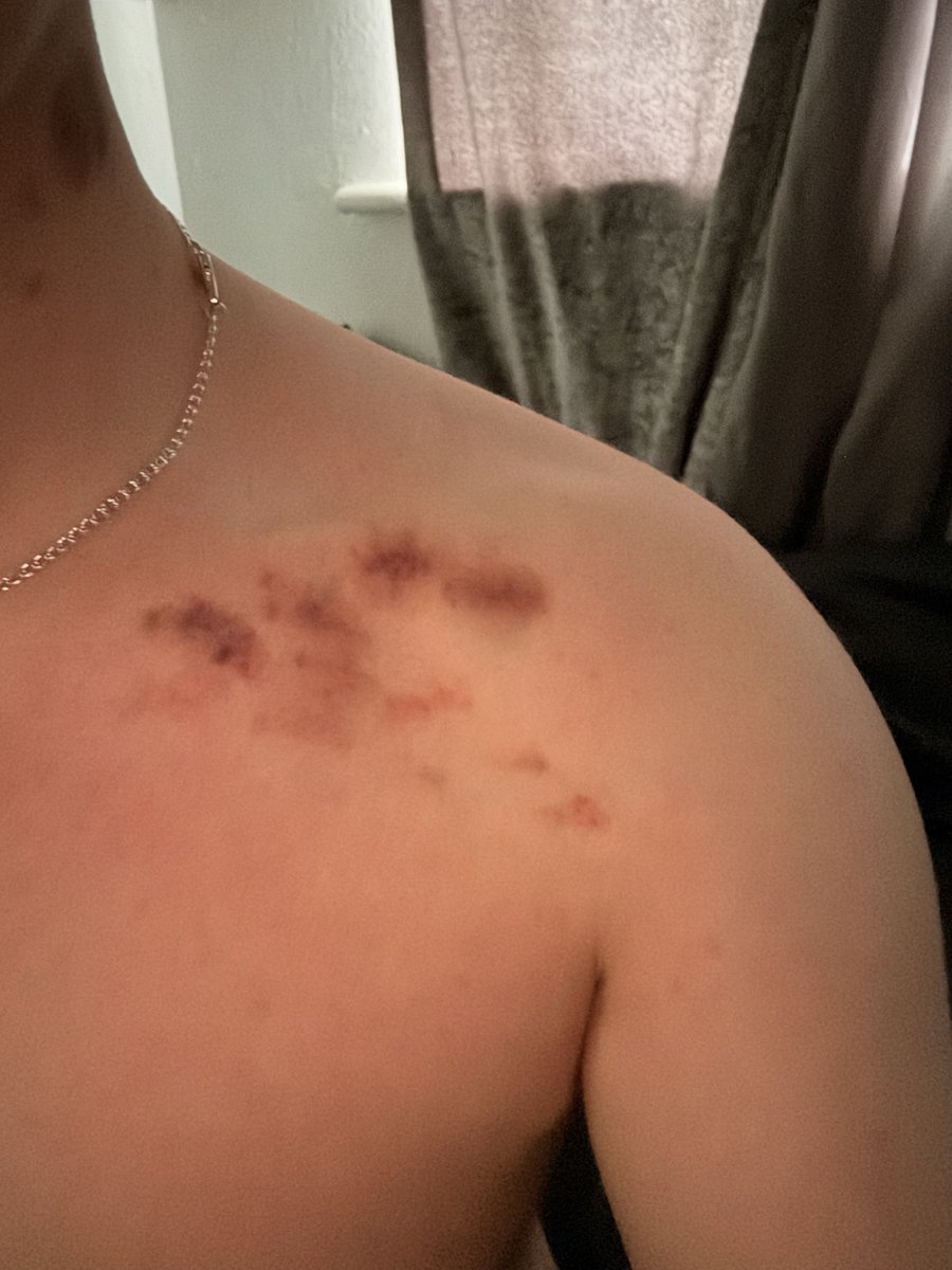 br🦇🇬🇧 tweet media