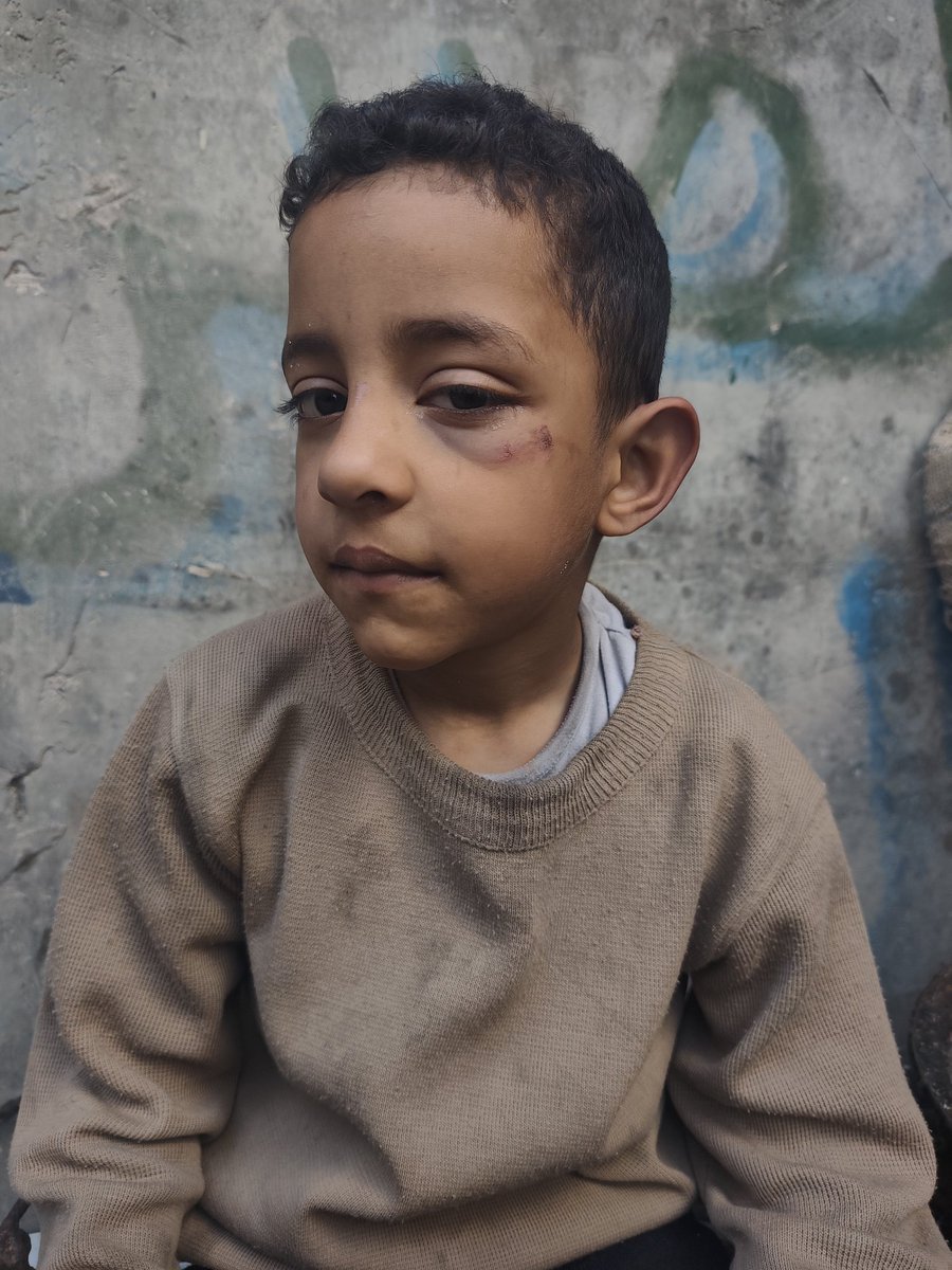 Nabhan0ab55's tweet image. URGENT PLEA ‼️

I beg anyone reading this to feel my pain!
We have nothing left, and I’m doing everything I can to save my family.🥺
Is there a kind heart out there who will answer this call? 💔🙏
chuffed.org/project/176544…