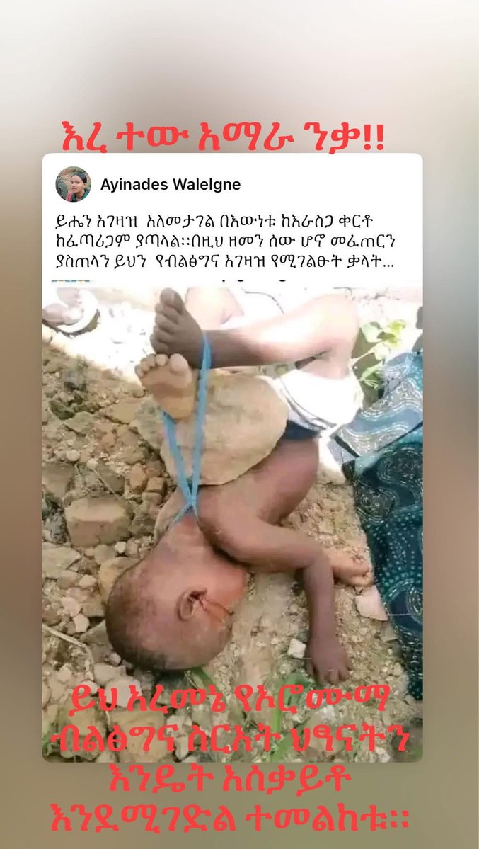 የግፍ ጥግ ተመልከቱ የአማራ ህፃናት ኑሯቸው ይህን ይመስላል።