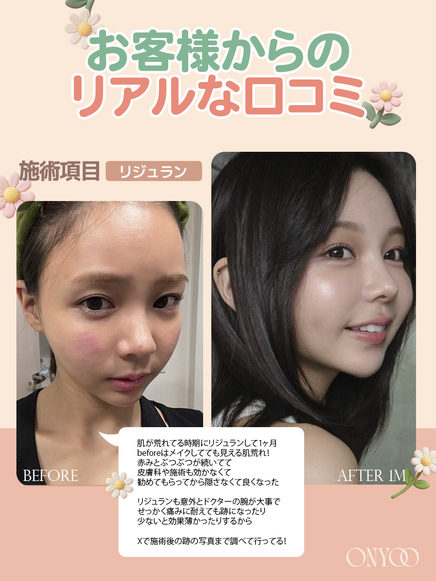 オンユ美容整形外科・美容皮膚科 【額縮小/挙上/リフトアップ】専門🎖 tweet media