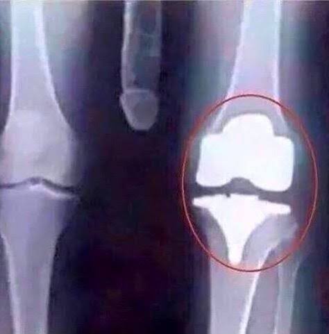 Mengão TETRA Rage Comics tweet media