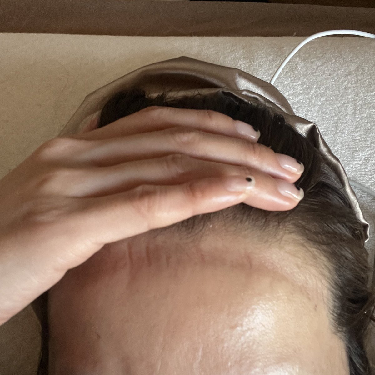 やばい、ナイトキャップの締め付けがあざレベル…