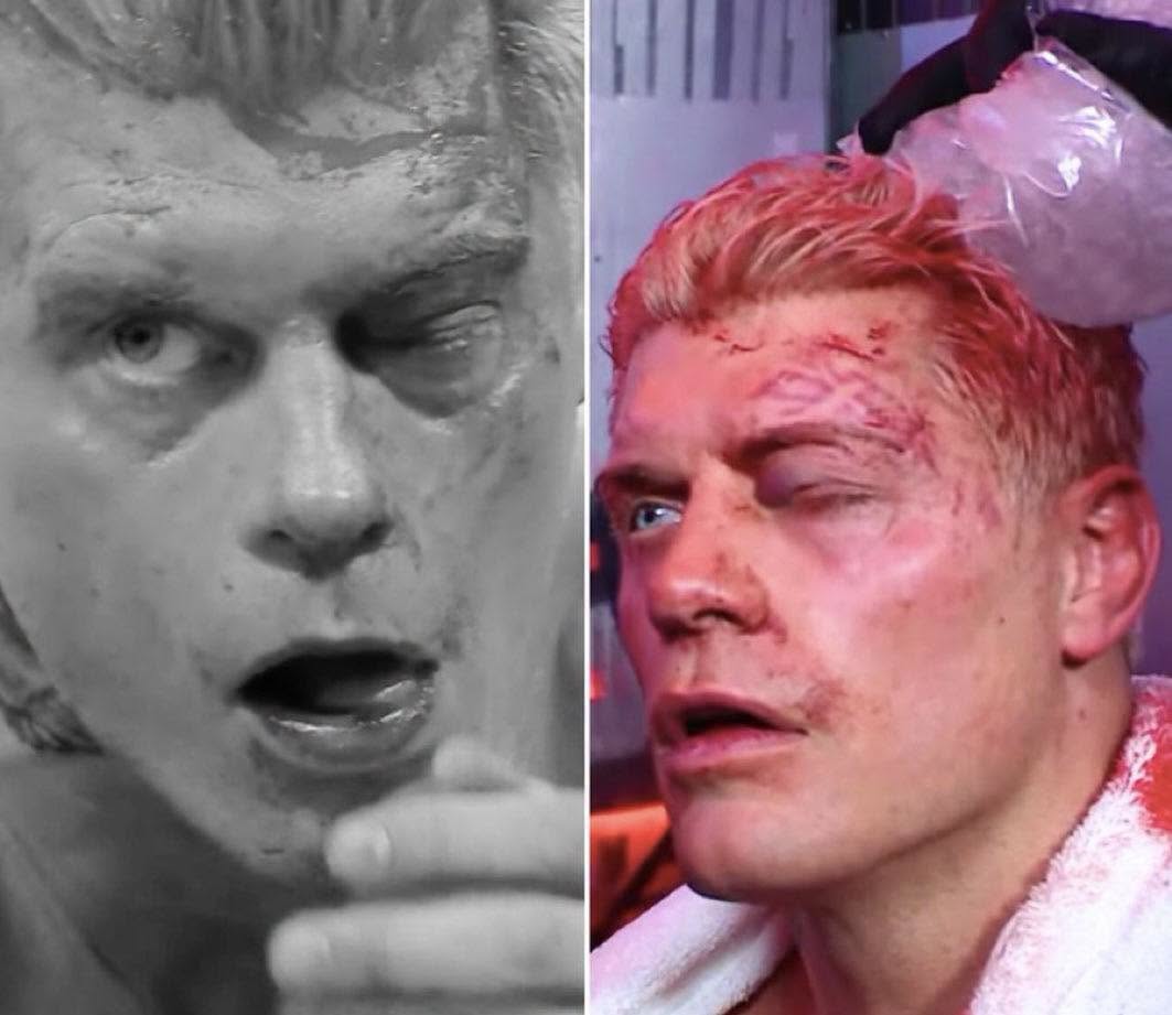 🚨 Cody Rhodes a été ouvert à plusieurs endroits, son œil était complètement gonflé et fermé, et il a dû recevoir plusieurs agrafes à la tête après son match de championnat face à Randy Orton. 

La WWE a déclaré que Cody Rhodes n’est actuellement pas autorisé médicalement à