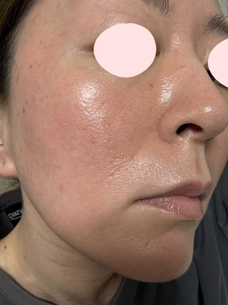 まみ※画像閲覧注意 tweet media