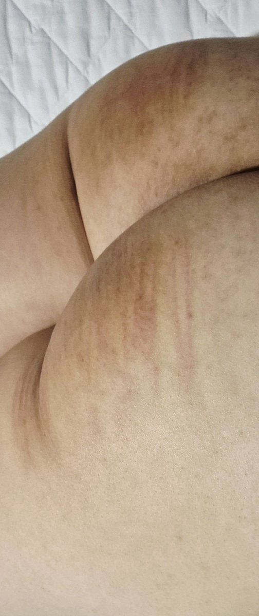 CaneMasa tweet media