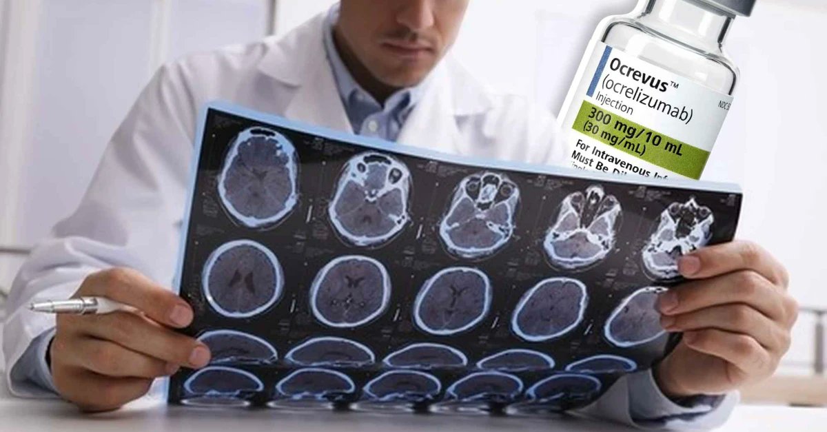 NovaReportNet's tweet image. 🚨 BREAKING: FDA reviewing whether to WITHDRAW Roche's €7B blockbuster MS drug Ocrevus. Critics cite 'zero efficacy' in some patients, a breast cancer signal, and data integrity issues at trial sites. #Roche #Ocrevus #FDA #Pharma #MS