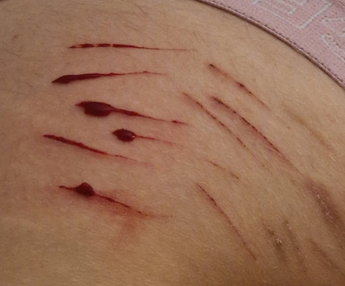 SIX of shedtwt tweet media