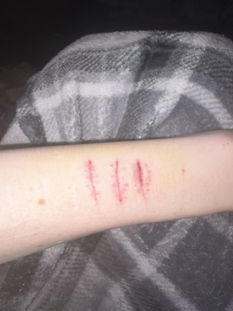 VIX OF #SHTWT tweet media