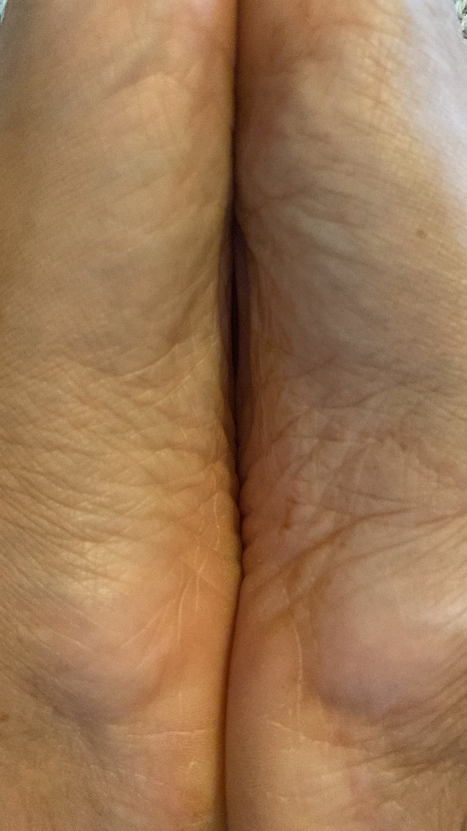 Princesssfeet_x's tweet photo. Getting closer… every crease, every wrinkle, every little detail 👣
Think you could handle exploring them properly?
#FeetFinder #WrinkledSoles #SoleLover #FootCloseup #FeetCommunity #ToeCurls #SoftSoles #FootFetish #PrettyFeet #FeetContent #BarefootVibes #FootModel #SoleShots https://t.co/rpVjpqGaST
