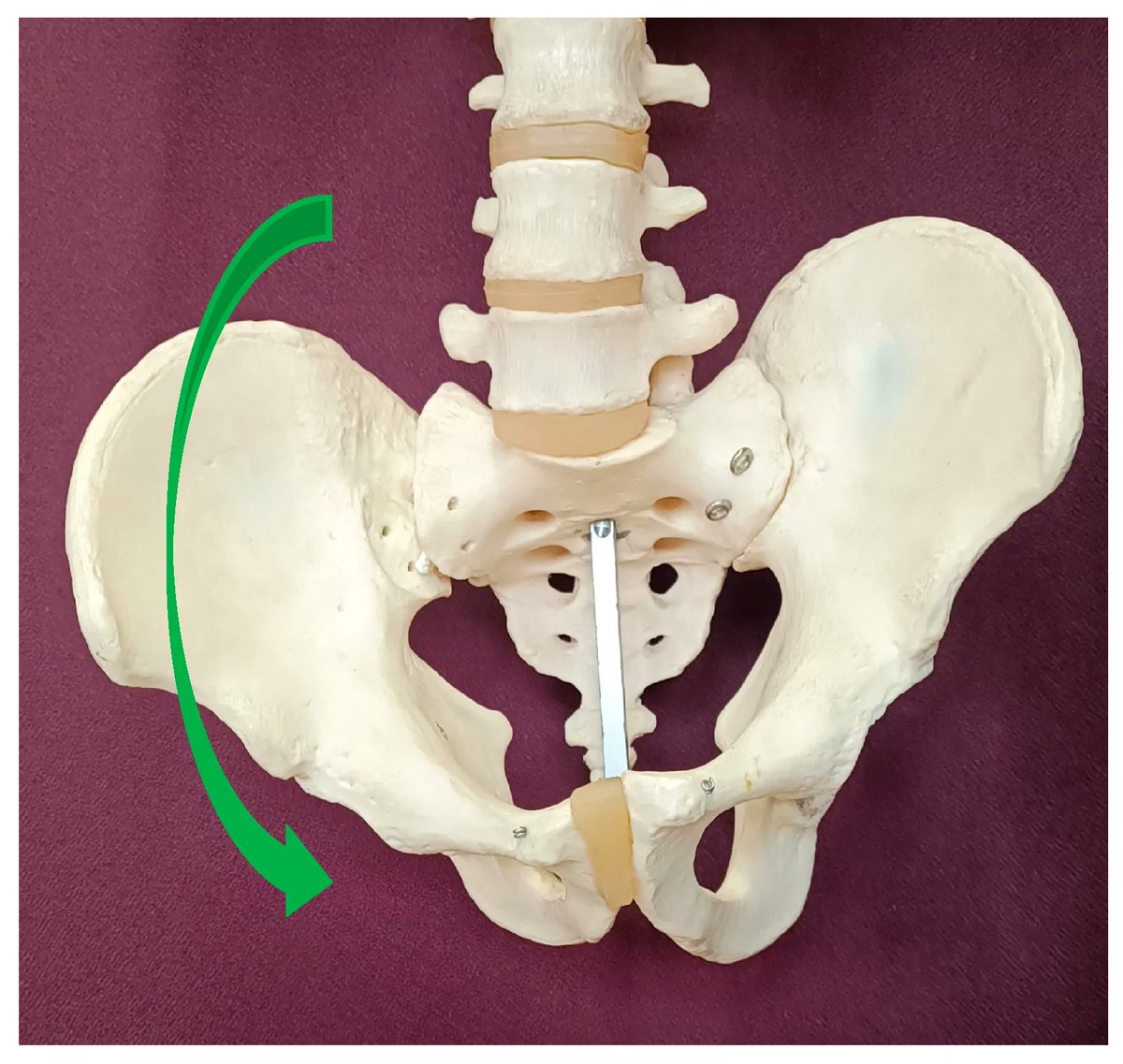 Symmetry_MDPI's tweet image. Editor's Choice Paper Recommendation: "Comprehensive Analysis of Pelvic Asymmetries in #LowBackPain, #Scoliosis, Post-Traumatic Pelvic Dysfunctions and Obstetric Changes: A Narrative Review Focused on Clinical Relevance".