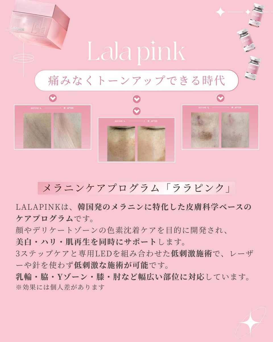 黒ずみ、隠してない？

本来は
隠すものじゃなく
整えるもの。

メラニンに特化したケアで
肌本来の色味へ。

韓国では常識のケア。

ララピンクで
透明感のある肌へ✨

#リンリン
#肌管理サロンリンリン
#ララピンク