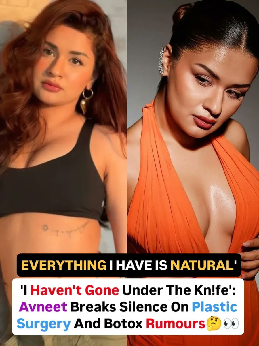 Filmy_Galaxy's tweet image. Gracefully shutting down the rumours ✨💫
Avneet Kaur says her glow-up is all natural—confidence, growth, and good genes over anything else 💖🔥
#AvneetKaur #NaturalBeauty #NoFilter #GlowUp #Confidence #SelfGrowth #CelebrityNews #ViralVibes #FilmyGalaxy