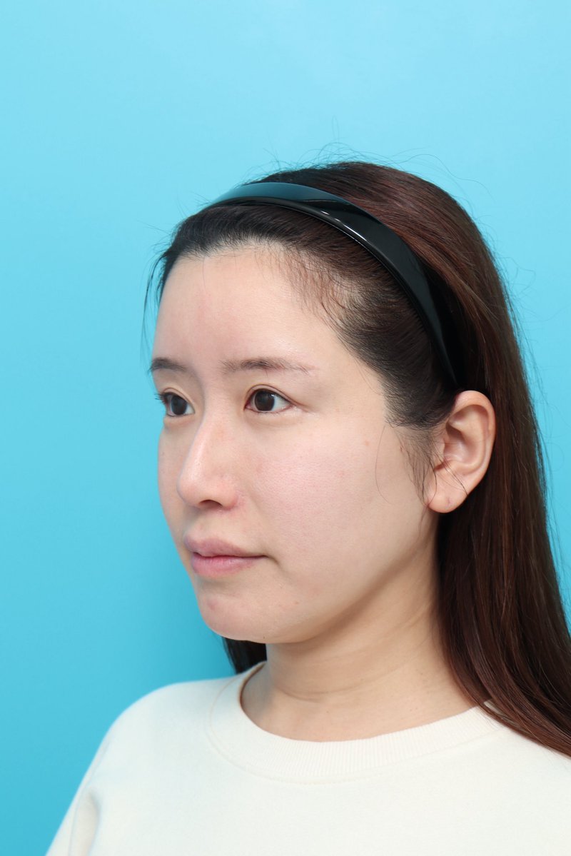 まりか🪽美容クリニック広報 tweet media