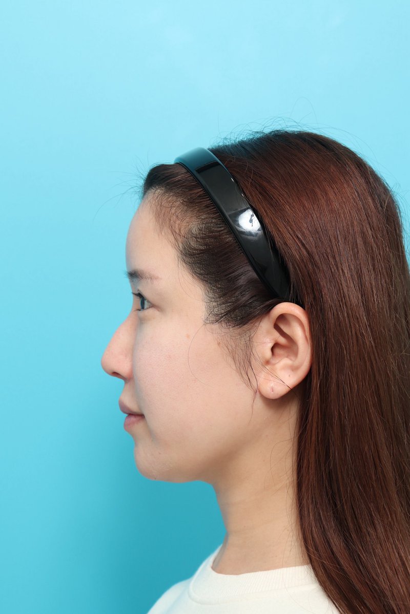 まりか🪽美容クリニック広報 tweet media