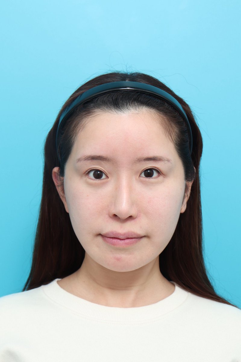 まりか🪽美容クリニック広報 tweet media