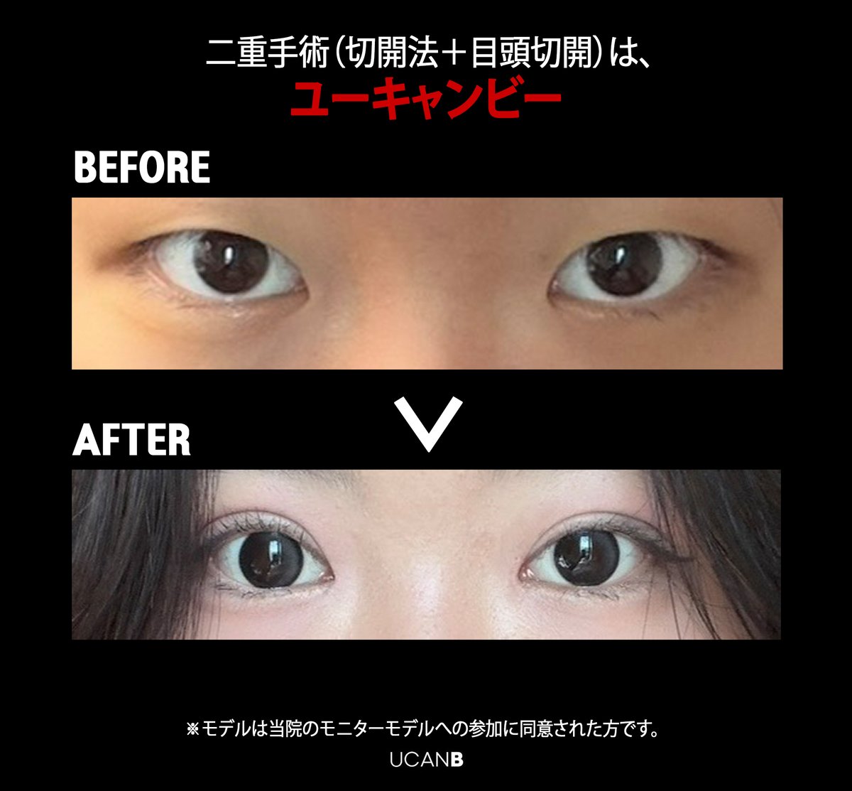 【公式】UcanB美容外科・皮膚科 tweet media