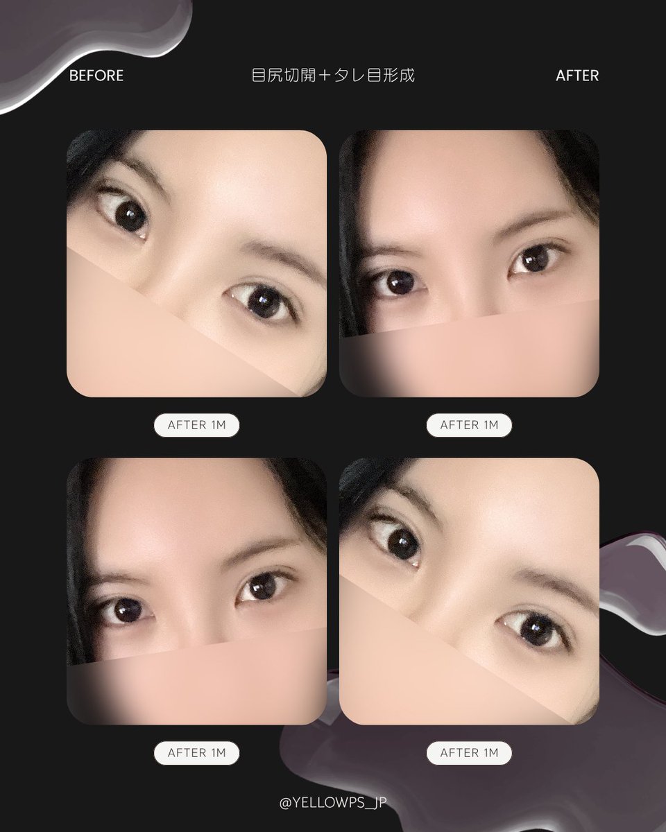 💛イエロー美容整形外科(公式)💛 tweet media