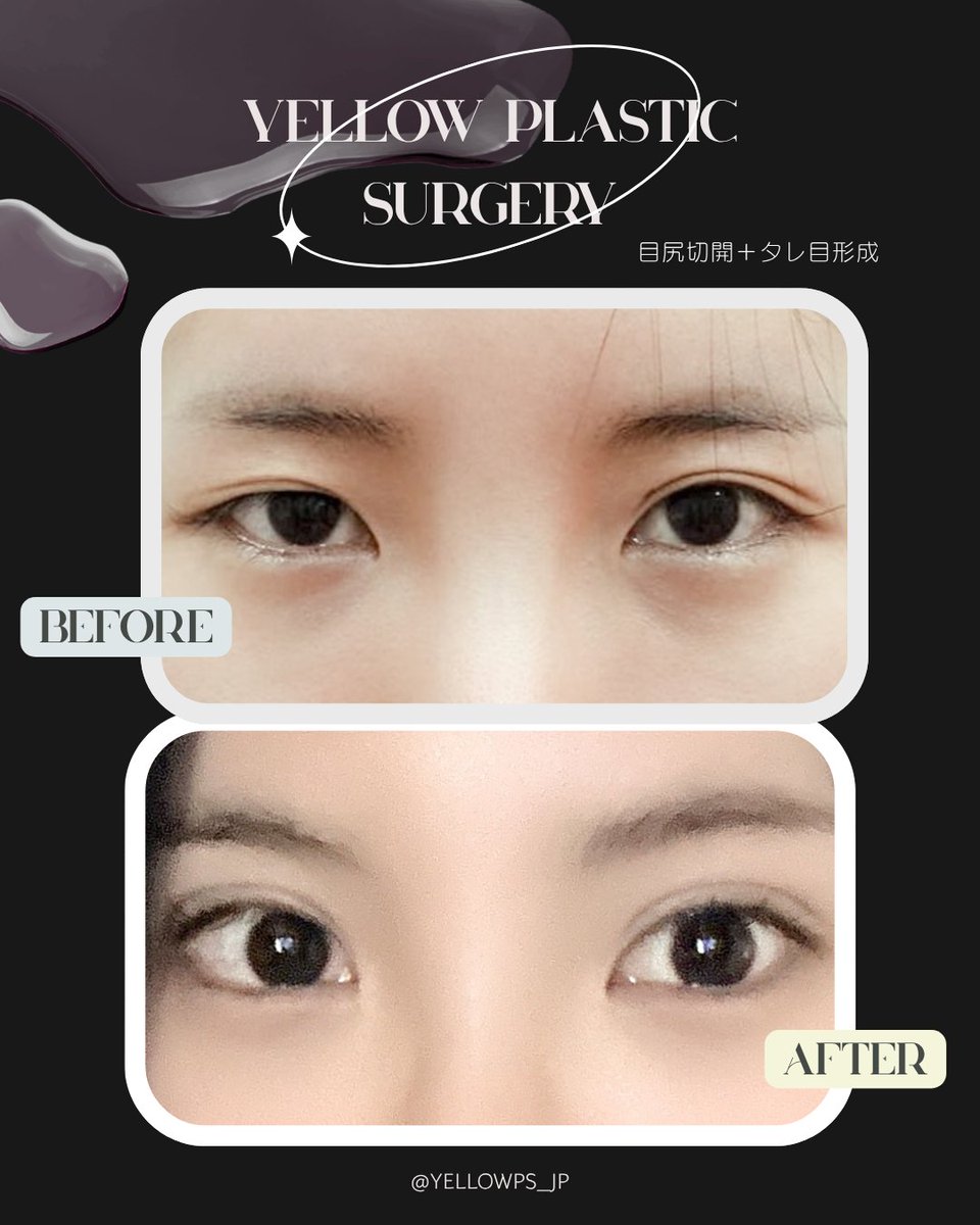 💛イエロー美容整形外科(公式)💛 tweet media